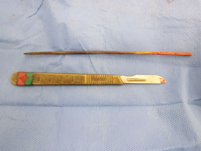 Skewer removed from dog